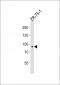 Phospho-RPS6KA5-S376.ctrl Antibody