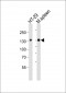 JAK1 Antibody (C-term)