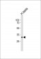 SYCP3 Antibody (N-term)