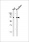 Lyn Antibody (Center)