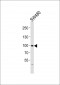 FGFR4 Antibody (N-term)