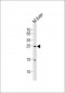 PDCD6 Antibody (Center)