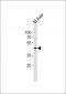 Mouse Csk Antibody (N-term)