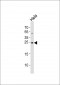 CDKN1A Antibody (C-term)