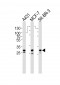 CTSD(heavy chain) Antibody (Center)