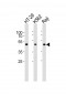 IL13RA1 Antibody (C-term)