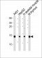 UBE2D1 Antibody (C-term)