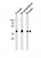 ALDOC Antibody (C-term)