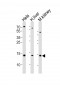 CDA Antibody (Center)