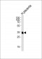 FOLR2 Antibody (N-term)