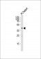 ACTG2 Antibody