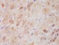 CSP Antibody
