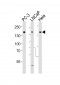 Tuberin (TSC2) Antibody (S1798)