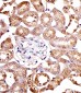 SPHK1 Antibody (N-term P74)