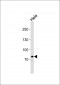 PCSK9 Antibody (C-term)