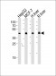 IDH1 Antibody (Center)