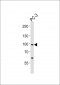 SCAP Antibody (Center)