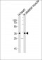 DIO2 Antibody (Center)