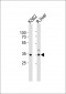 ATP1B2 Antibody (Center)