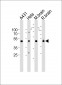 NDUFS2 Antibody (Center)