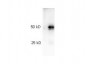 Anti-Rabbit IgG (H&L)  (Peroxidase Conjugated) Pre-Adsorbed Secondary Antibody