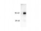 HRP RABBIT IgG (H&L) Second Antibody Pre-adsorbed