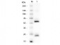 Anti-Human IgG (H&L)  Secondary Antibody
