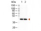 Anti-RABBIT IgG (H&L)  (Peroxidase Conjugated) Secondary Antibody