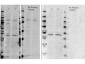 Anti-RABBIT IgG (H&L)  (Peroxidase Conjugated) Pre-Adsorbed Secondary Antibody