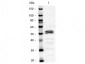 Anti-Mouse IgG1  (Alkaline Phosphatase Conjugated) Secondary Antibody