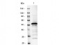 Anti-Mouse IgG2a (Gamma 2a chain)  (Alkaline Phosphatase Conjugated) Secondary Antibody
