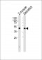(DANRE) dixdc1a Antibody (Center)