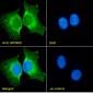 MTMR9 (C Terminus) Antibody (C-Term)