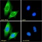 Tryptophan hydroxylase 2 / TPH2 Antibody (internal region)