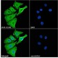 IL1R2 Antibody (internal region)