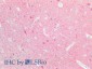 UCHL1 (aa 58-68) Antibody (internal region)