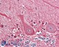 SEPT4 (aa425-435) Antibody (internal region)