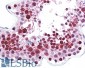 HSPC117 (aa201-215) Antibody (internal region)