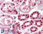 HSPC117 (aa125-138) Antibody (internal region)