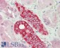 DDX41 (aa468-480) Antibody (internal region)