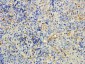 MTMR9 (C Terminus) Antibody (C-Term)