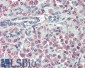 Prealbumin / Transthyretin Antibody (internal region)