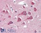 HRASLS3 / HREV107-3 Antibody (N-Term)