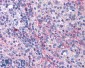 eIF5A Antibody (internal region, near N-Term)