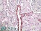 TGFBI Antibody (internal region)