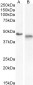IL1R2 Antibody (internal region)