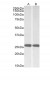 UCHL1 (aa 58-68) Antibody (internal region)