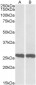 UCHL1 (aa 211-221) Antibody (C-Term)