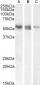 RORC (aa200-212) Antibody (internal region)