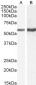 TGFBR1 (aa50-63) Antibody (internal region)
